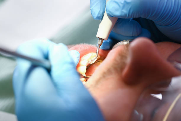 Best Urgent Dental Care for Toothache in Houston, MO