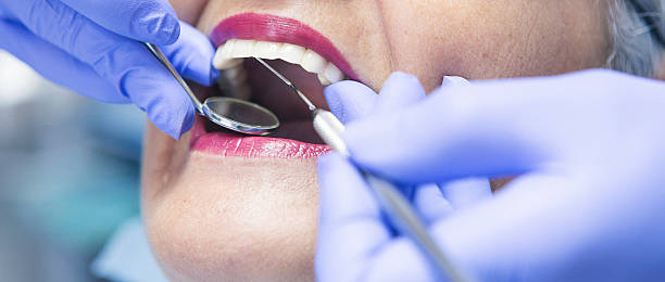 Best Emergency Root Canal Treatment in Houston, MO